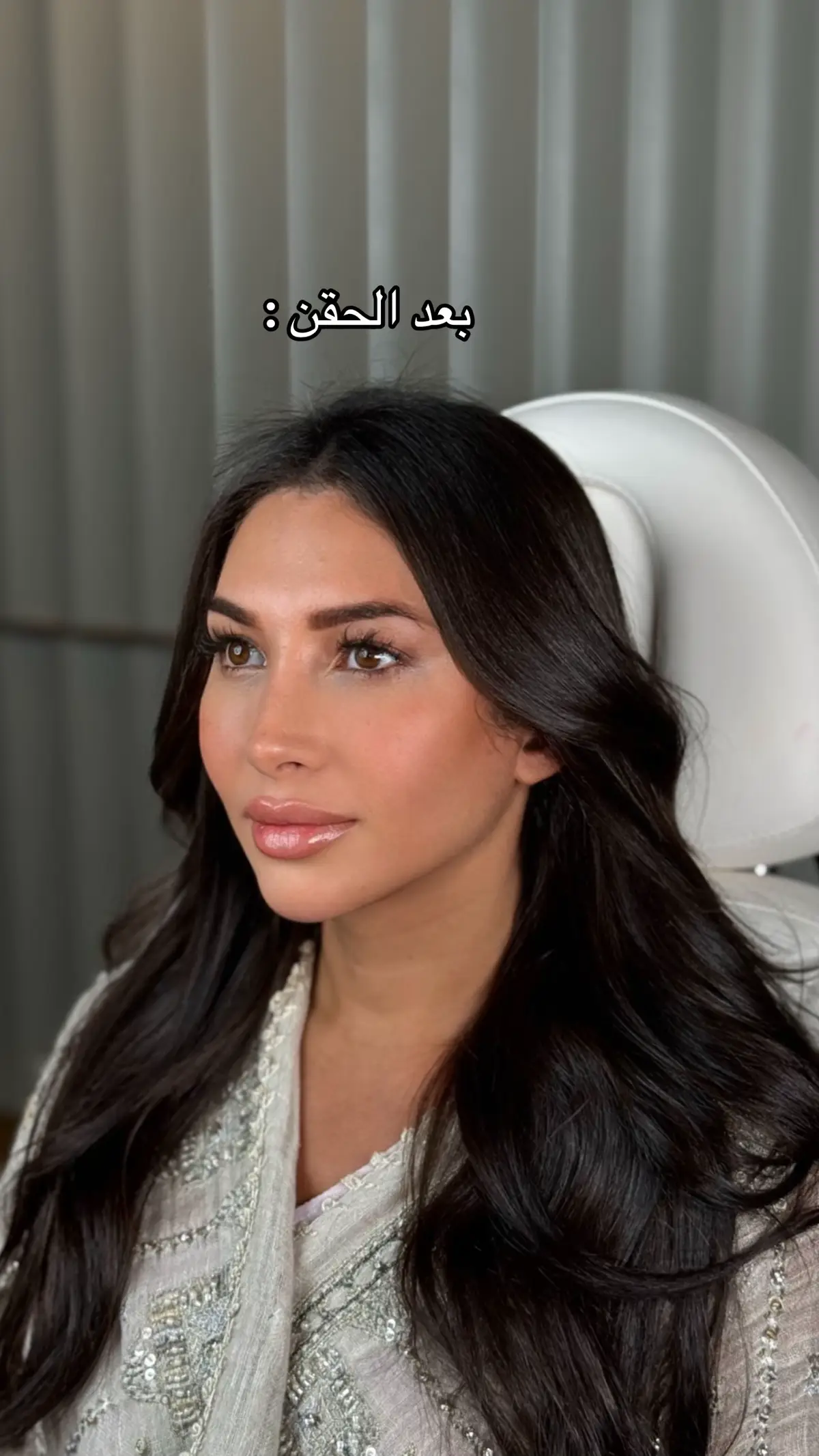 كونتور فل فيس + فيلر شفايف + فيلر تحت العين 👄❤️‍🔥