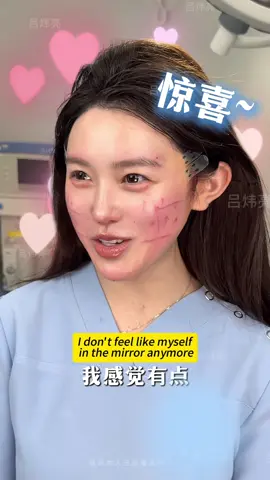 Late nights left her face puffy, sagging, and tired, with deep smile lines and uneven contours. Dr. Xie’s 9D Facelift restored balance: lifting and tightening the skin, repositioning the apple cheeks, and refining the chin and eye area. In just one hour under local anesthesia, she regained a smooth, youthful, and radiant look—ready to shine on and off camera. ✨💎 #9DFacelift #YouthfulGlow #FacialRejuvenation #NaturalLift