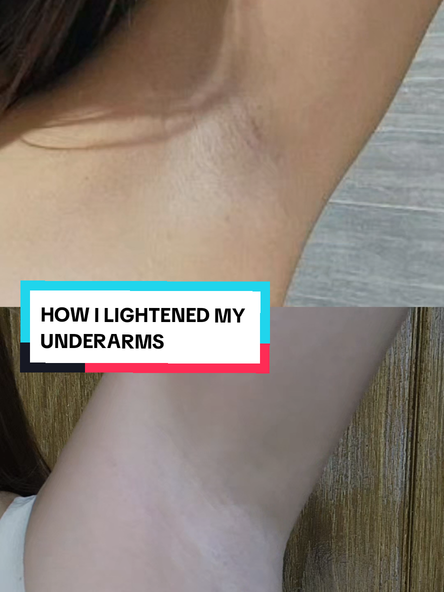 Kili-kili Reveal! LOVE MY NEW SERUM DEO! 💜🩷 #ActiveDrySerumDeo #Deodorant #WhiteningDeodorant #Underarm #Fyp 