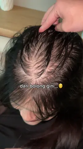 cek keranjang kuning sebelum diborong abiss👇🏻👇🏻 #shrd #shampoo #essence #hair #rambut #haircare #hairtreatment #hairfall #hairloss #rontok #tipis 