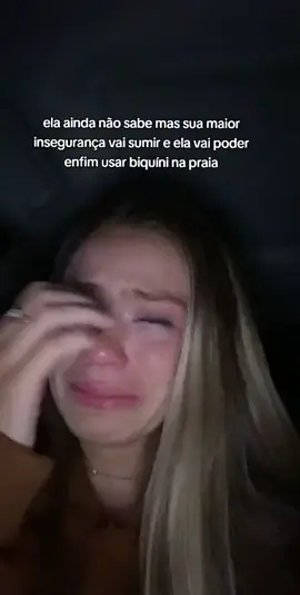 ela não sabe ainda mais nunca mais as estrias dela vão sumir🥹 #estrias #creme #cremerosa #resultadoreal #adeus 