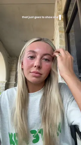 Just your reminder that what you see on social media doesn’t always show real skin blemishes and texture. I also know that people have it worse— I’m just being honest with how I feel. I could go weeks with perfectly clear skin and then sometimes have a “bad” month or two. And that shouldn’t determine how I feel on the outside. Acne doesn’t define your beauty & that goes for men too!! Thank you to the two sweet girls that made my entire day this morning❤️ 