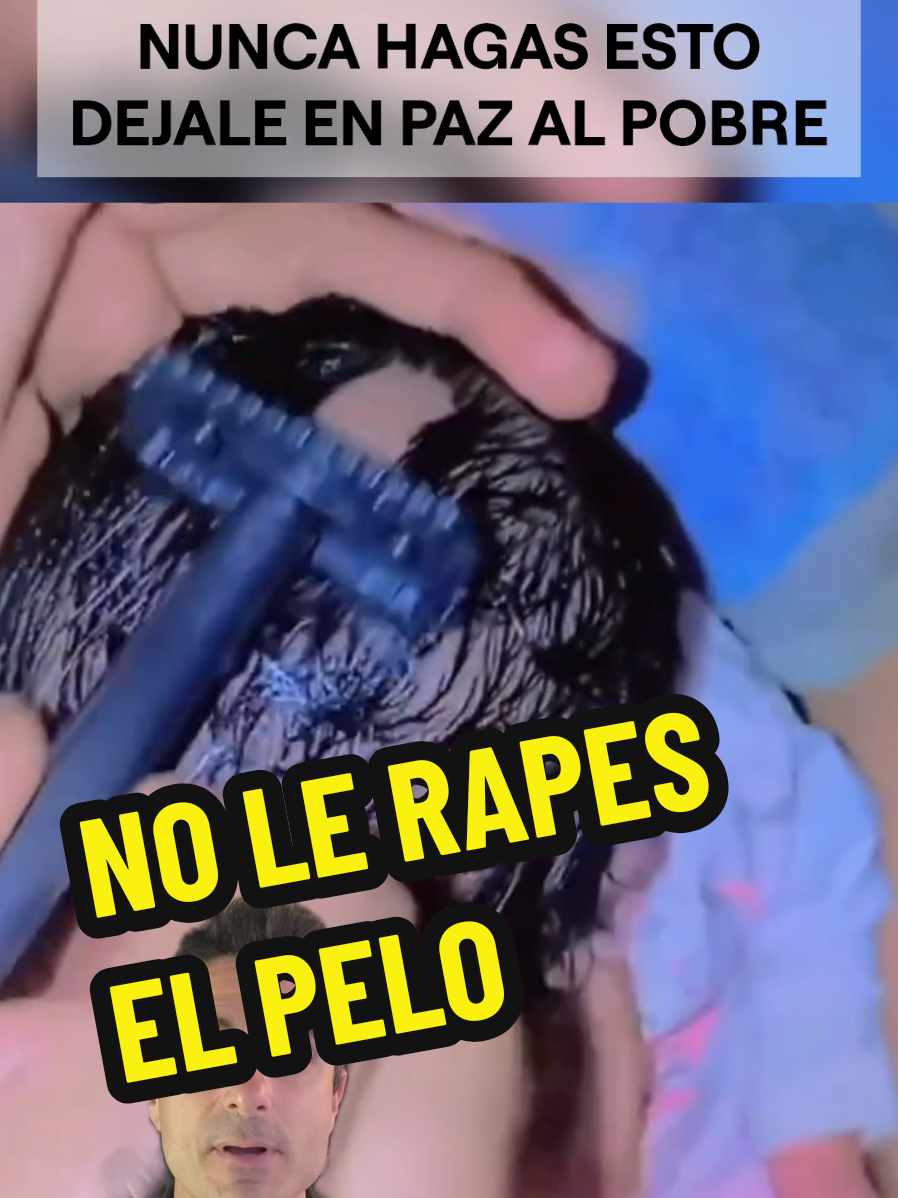 No rapes la cabeza a tu bebé.#supervivencia #SabiasQue #curiosidades 