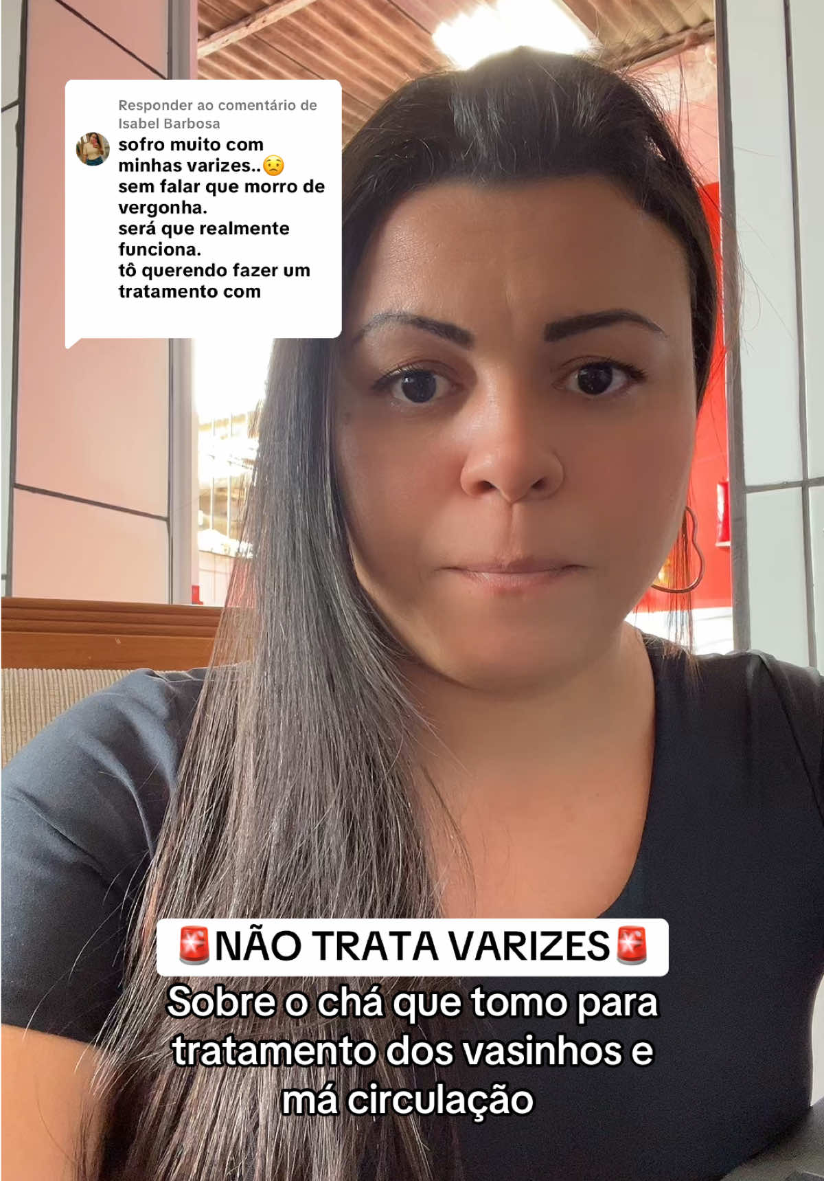 Respondendo a @Isabel Barbosa  #varizes #vasinhos #vascular #doresnaspernas #fypシ゚ 