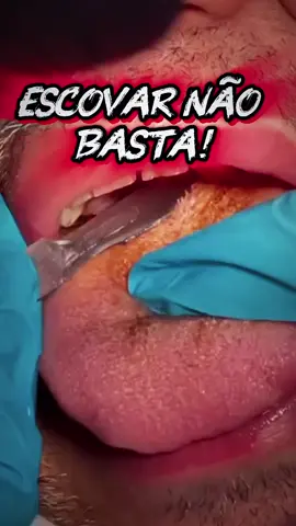 Acabou o bafo invisível 😲💨 Kit raspador de Língua - só no TikTok Shop. 🔥 🔥 🔥 #raspadordelingua #higienebucal #Oferta #acessoriosmasculinos #saudebuca 