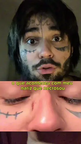 O que aconteceu com meu nariz? #dependenciaquimica #reabilitação #nariz #larva 