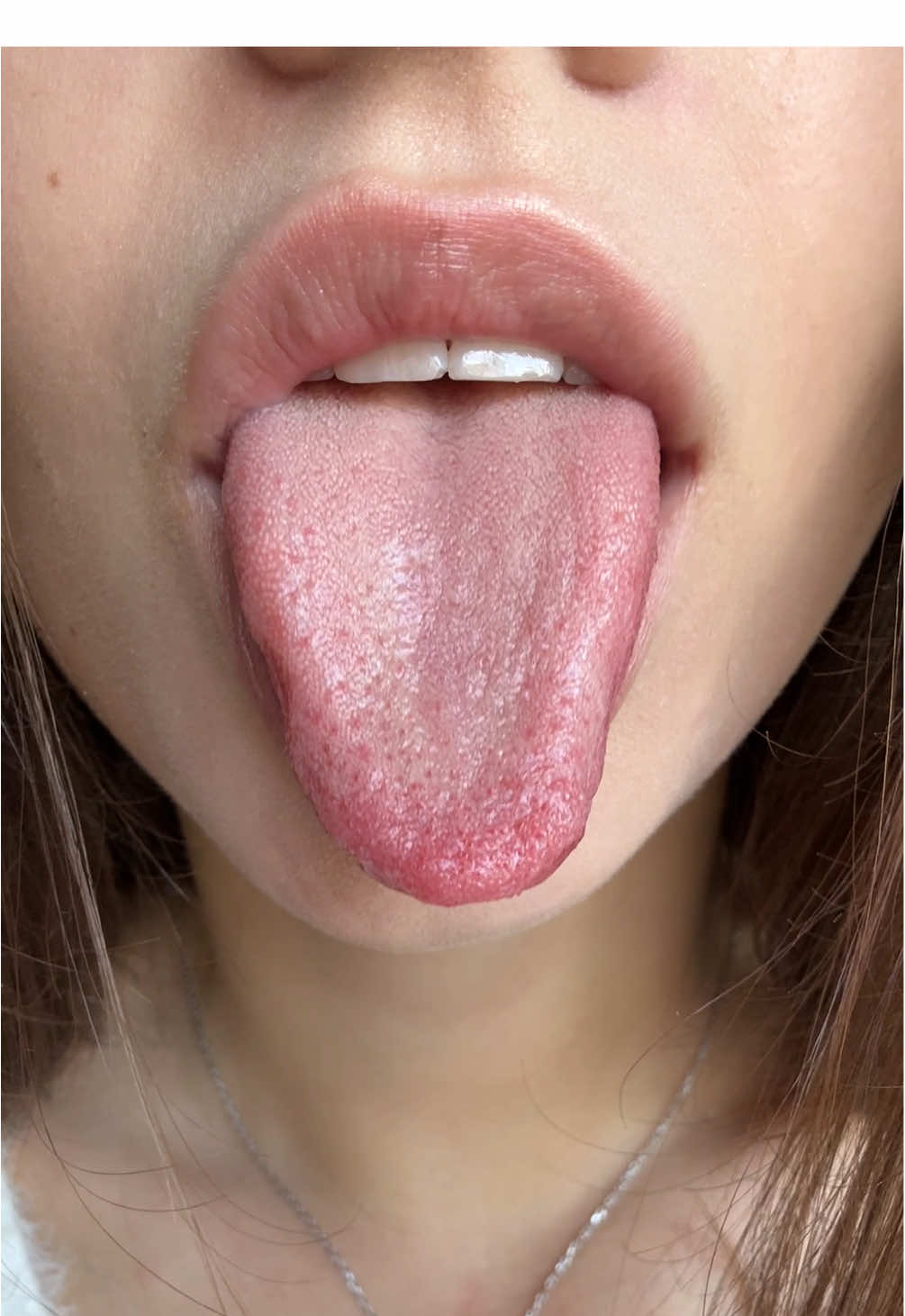 #fyp #asmr #mouthsounds 