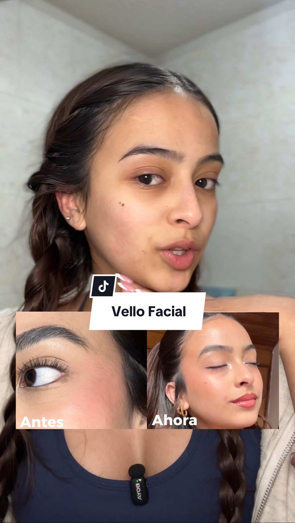 Respuesta a @Yurí así elimino el vello facial 💖 #tips #vellofacial #depilacionlaser #girls #belleza 