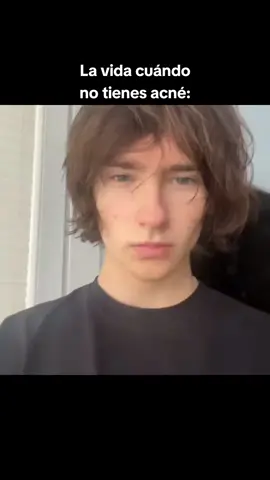 #looksmaxing #mogger #looksmax #mogging #lksxxer 