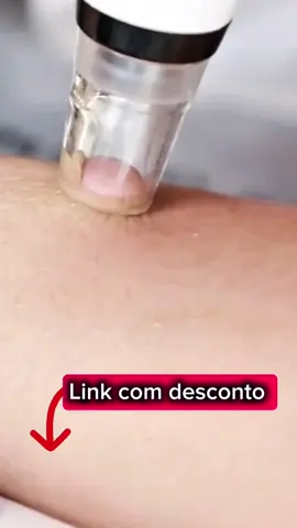 Adeus cravos e pele oleosa! Esse aspirador elétrico facial limpa os poros profundamente, remove impurezas e deixa sua pele lisinha e renovada em minutos. Fácil de usar, portátil, com diferentes ponteiras para cada área do rosto e recarregável por USB. É a praticidade de uma limpeza de pele profissional direto na sua casa! 🛒 Aproveite o desconto especial e clique no carrinho laranja agora mesmo para garantir o seu! #Skincare #PelePerfeita #LimpezaDePele #TikTokMeFezComprar #OfertaEspecial 