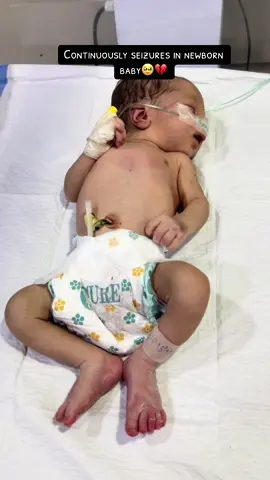Continuously fits in this baby due to delay cry after delivery 😔Pray for this baby 🥹💔🙏 #nicucare #PreemieWarrior #viral #foryou #tiktokdoctor 