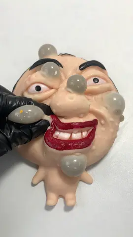 ASMR-沉浸式痘痘爆裂#pimplepopping #oddlysatisfying #satisfying #asmr #diytoys 
