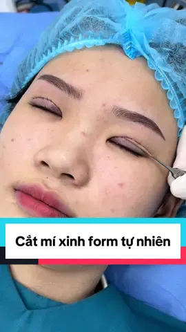 Cắt mí fulldeep cho em khách hàng thích sự tự nhiên nhất ❤️❤️❤️ #catmi #catmidep #suami #xuhuong #ilovetiktok 