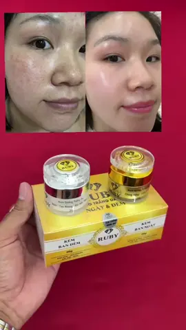 kem Face Ruby Ngày & Đêm  #viral #xuhuong #kemfaceruby #kemfaceruby 