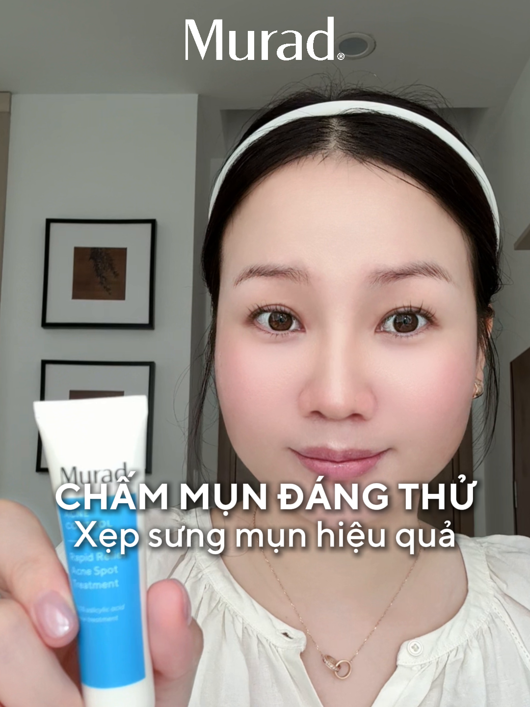 GEL CHẤM MỤN NHANH XẸP, HIỆU QUẢ MÀ BEAUTY BLOGGER MUỐI BIỂN LUÔN TIN TƯỞNG! Hiệu quả ngay với những nốt mụn viêm sưng đỏ- Rapid Relief Acne Spot Treatment làm dịu đau, hỗ trợ giảm sưng và gom cồi để mụn sưng không còn là nỗi lo của bạn. Trải nghiệm ngay. #muradvietnam #mụn #rapidrelief