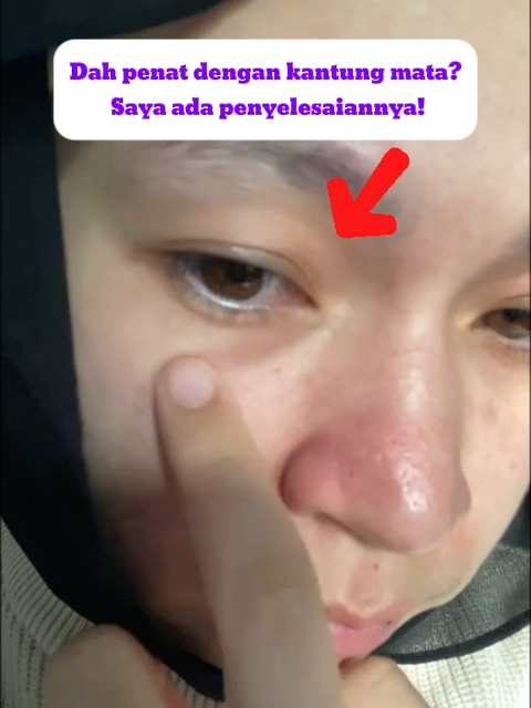Eyebag tebal macam drama 100 episod? Guna Lanbena Eye Patch — terus hilang! Mata segar, orang ingat kau baru lepas honeymoon! Join the Live!! #eyescream #SelfCare #lanbenamalaysia #lanbenaeyepatch #skincarehacks #skincareroutine #fypツ #matapanda #eyebag #retinol #eyepatch #tipsskincare #peptide #lanbenaeyemask1