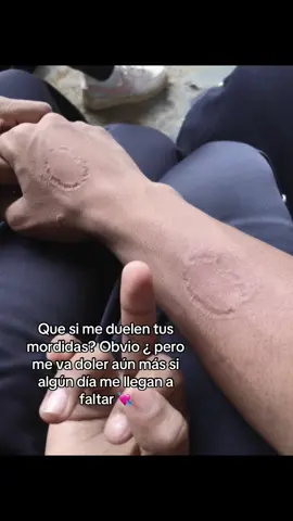 🥺#amor#mordidasdeamor💕💕💕💕💕💕 @Llumi-2008🩵🕊️ 