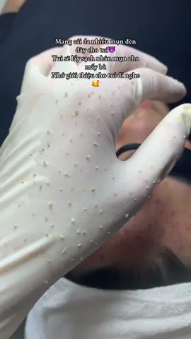 Mang cái da nhiều m.ụ.n đến đây cho tui😈 Tui sẽ lấy sạch nhân m.ụ.n cho mấy bà Nhớ giới thiệu cho tui dí nghe #xuhuong #ilovetiktok #trietlong #goidauduongsinh #nanmun 