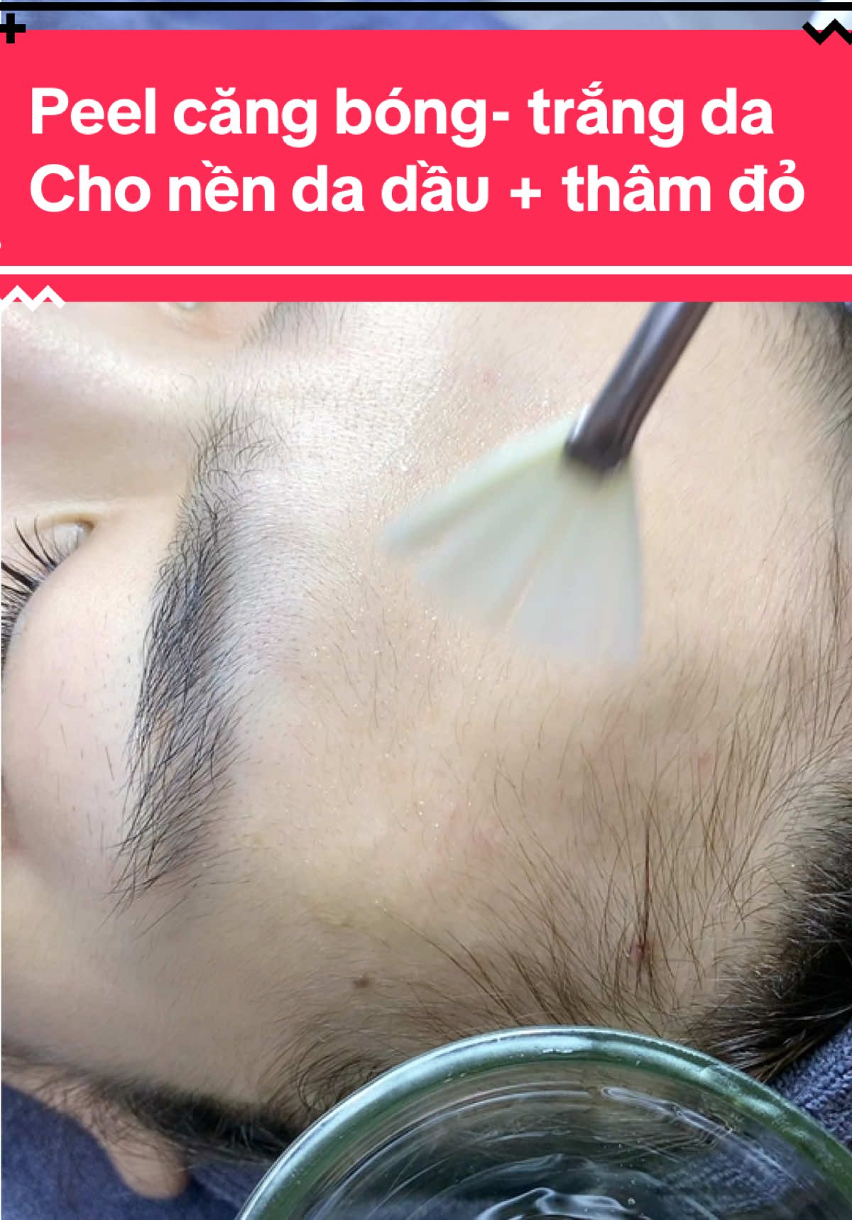 Peel căng bóng- trắng da  Cho nền da dầu + thâm đỏ#túdoli #daotaohocvienchuyennghiep #xuhuong #daotaohocvien #skincare #peeldadanang 