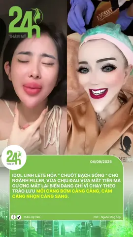 ⚠️ Idol Linh Lete hóa “chuột bạch sống” cho ngành filler: Chạy theo trend mà gương mặt biến dạng! #adsupmedia #gbngr #phongmokechuyen #thammy24h #tiktoknews  
