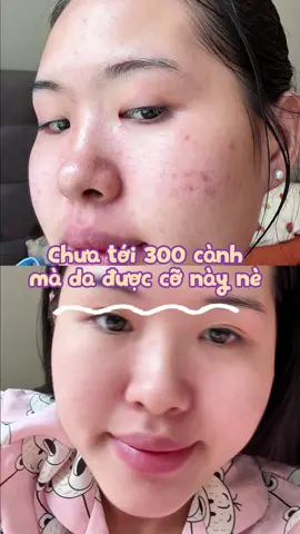 Chưa tới 300 cành mà da được cỡ này nè Video gốc từ @azd.doublecleansing  #reviewlamdep #skincare #skincareroutine #spa #doublecleansing