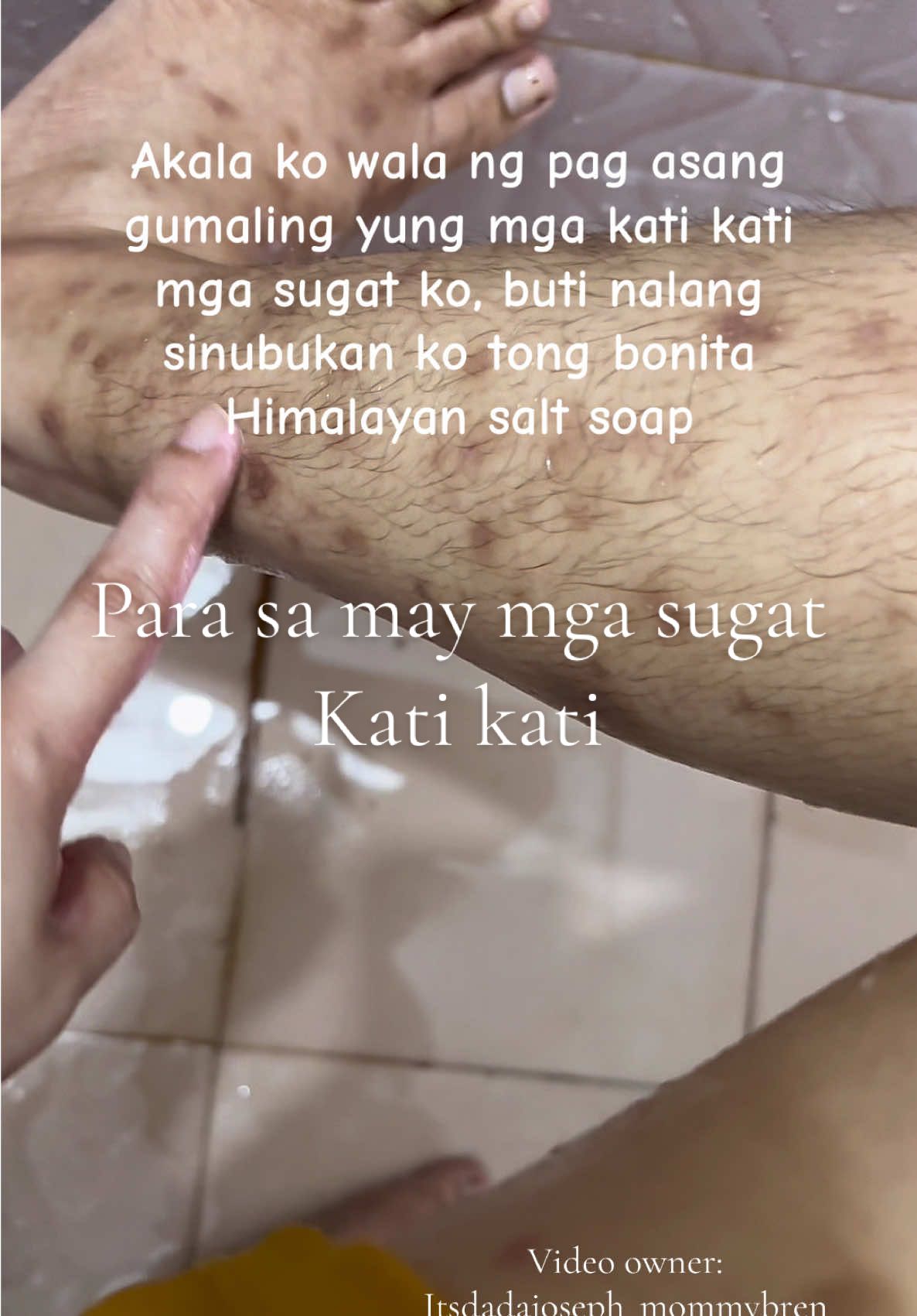 Sobrang laking tulong ng bonita Himalayan salt soap sa may mga skin problems lalo na kung sensitive skin ka #bonita #bonitasoap #himalayansaltsoap #skinproblem #sensitiveskin 