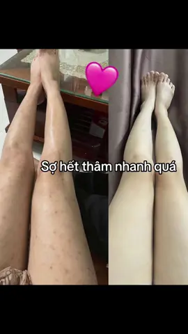 S ợ :)) #reviewlamdep #xh #chamsocda #duongtrangda #tritham 