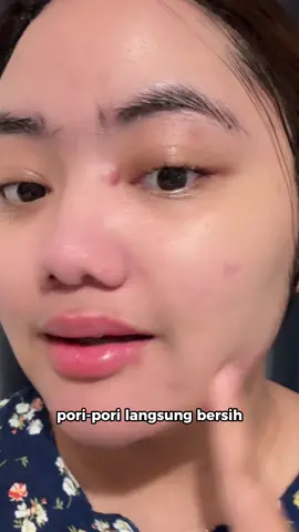 inget pakenya yang rajin tiap kulit pasti berbeda hasilnya! #drleo #drleoid #drleoclaymask #claymask #skincareindonesia 