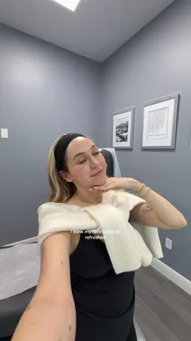 come with me to get poked in allll the different ways!! some cute lil hand tattoos and my second round of PRF EZGEL at @V/O Med Spa #prf #prp #handtattoo #diml #undereyefiller 