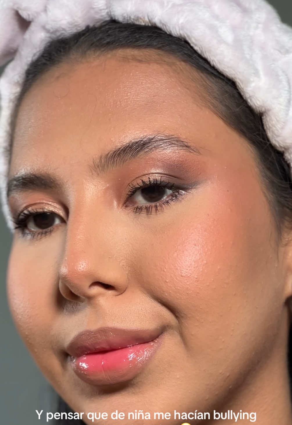 Y ahora bebé todas quieren botox 🫦🫶🏼  #bullyingawareness #botox #labios #fyp 