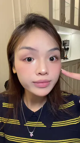 K thế sống thiếu mi