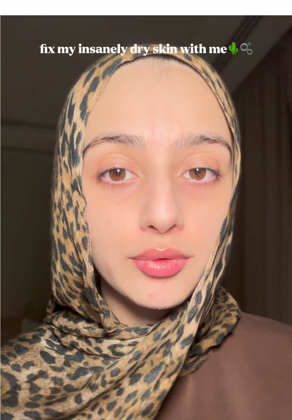 The biggest downside of tretinoin in my opinion 💔  Products:  @ROUND LAB dokdo toner  @medicube global PDRN serum  @Beauty of Joseon retinol eye cream  @Tatcha US dewy milk moisturizer  @Kosas plump + juicy collagen spray serum  #fyp #skincare #routine #tretinoin #foryoupage❤️❤️ 