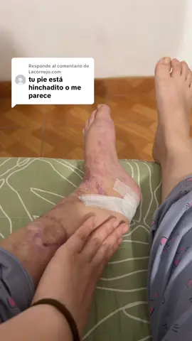 Respuesta a @Lacornejo.com  #cirujia #flypシ #operacion #tendon #paratiiiiiiiiiiiiiiiiiiiiiiiiiiiiiii 