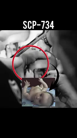 SCP-734 appears to be a male human infant between seven and eight months of age. SCP-734 shows normal development and health for a child of his age and genetic background. No abnormal genetic mutations, infections, or rare cellular disorders have been found during any test, and no origin point or cause has been found for the effect SCP-734 has on human tissue. #fyp 