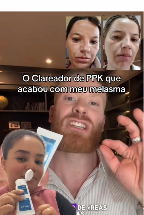 #melasma #manchas #melasmatreatment #protetorsolar #skincareviral 