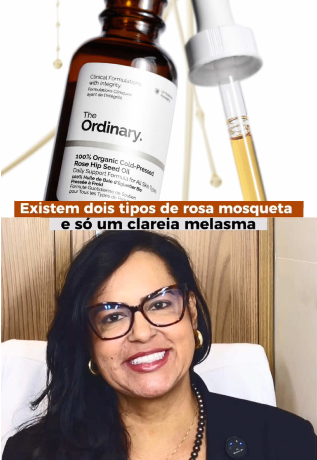 Você sabia que nem todos os óleos de rosa mosqueta são iguais? 🤔 Muitas mulheres usam produtos achando que estão tratando suas manchas, mas a diferença entre eles faz toda a diferença e pode impactar diretamente nos resultados. No caso do melasma, isso é ainda mais importante: não é só sobre o produto, é sobre protocolo certo, avaliação personalizada e constância. Quer aprender a cuidar da sua pele com segurança e realmente ver evolução? Salva esse vídeo e acompanha meus conteúdos para descobrir como tratar seu melasma de forma consciente e eficaz. 💫 . . . . . . . . . . #melasma #vaiprafy #esteticafacial #clinicavanessacabral #peleuniforme       