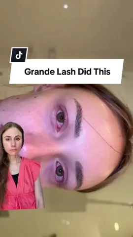 Beware of lash growth serum side effects. #grandelash #lashserum #dermatologist @rhegancoursey