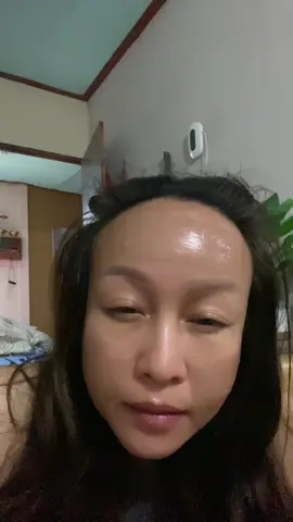 มีคนทักว่าไปฉีดโบมาหรอ #เทร์นด์วันนี้ #ซิลิโคนลดรอยแผลเป็น #นายหน้าtiktokshop #Titok