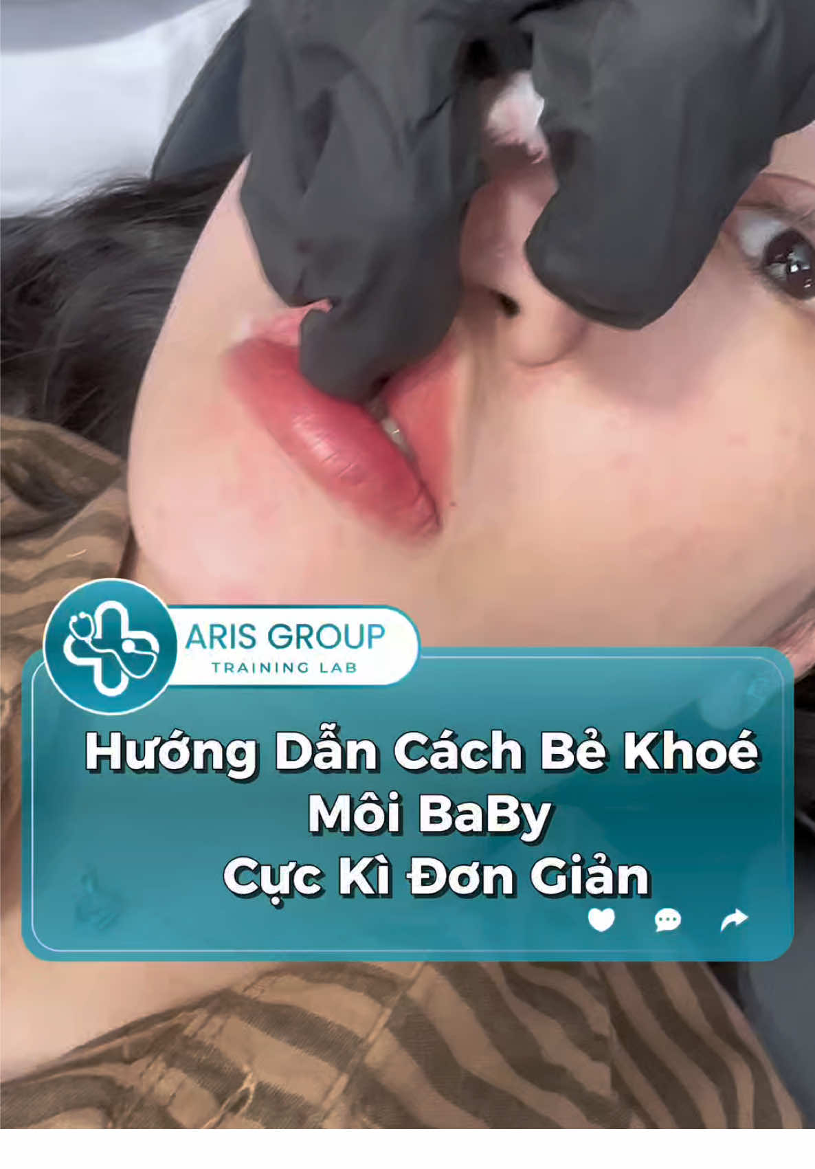 Bẻ khoé môi đơn giãn chỉ bằng 2 công thức #xuhuong #arisaesthetictraininglab #TruyềnLửaNghề #botox #lamdep 