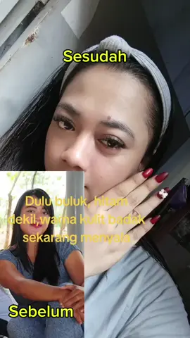 Dulu kulit badak,hitam, dekil. sekarang menyala.. menyala Hb ku 😍 #fyppppppppppppppppppppppp #viral #bodycare 