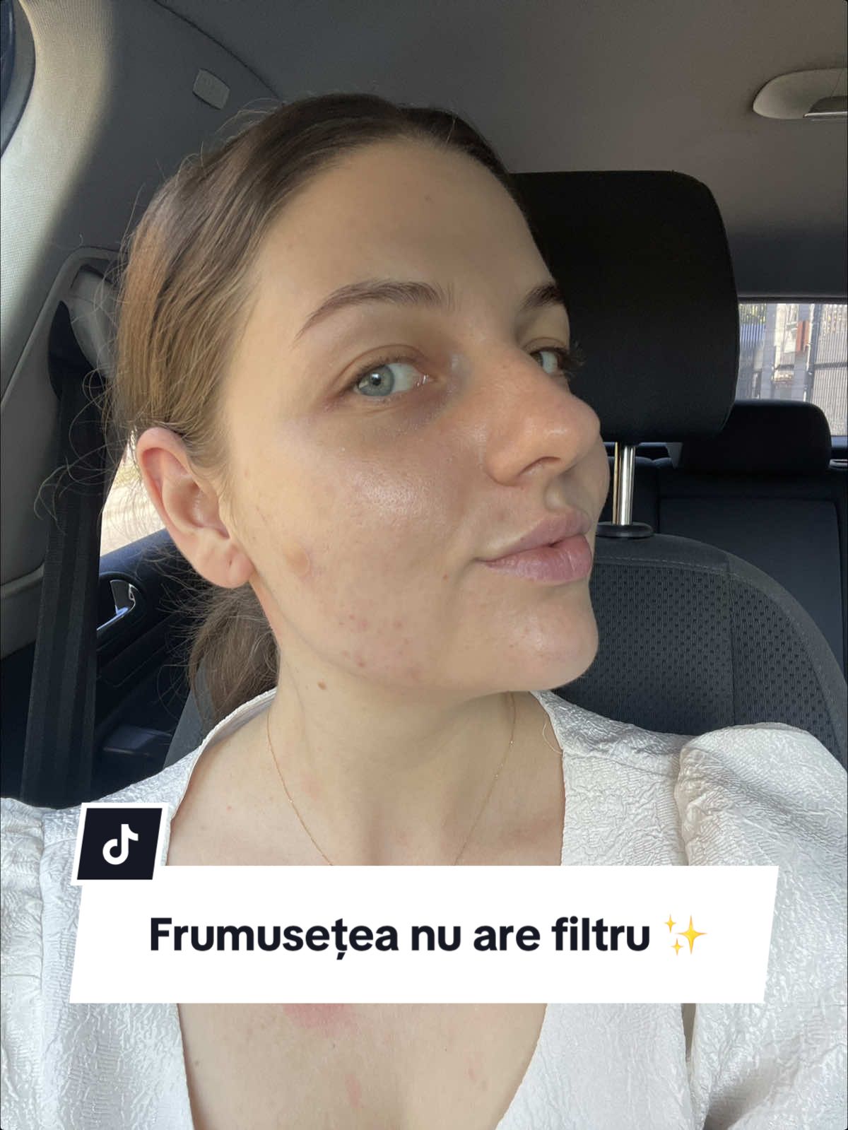 Toți avem imperfecțiuni. Dar asta ne face reali, autentici și unici 💎 Nu te ascunde, lumea are nevoie de adevăratul TU. Fii #fixeu  #selflove #loveyourself #selfacceptance #confidence     