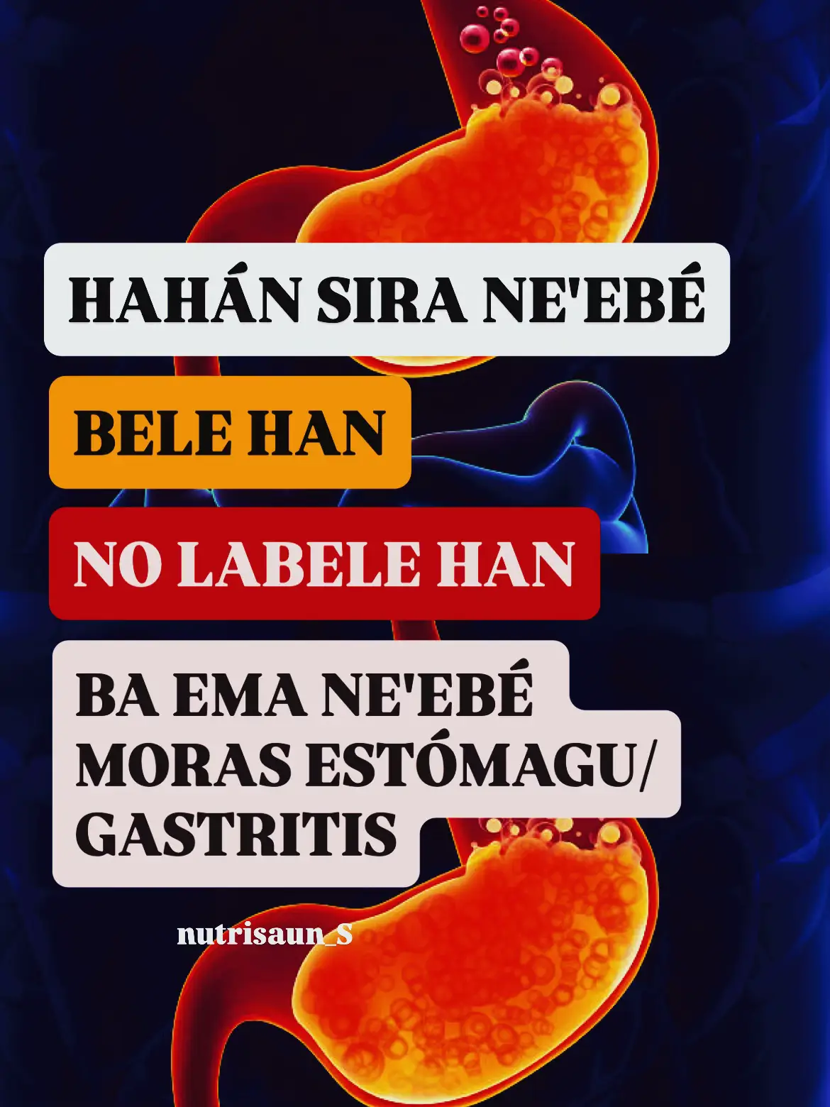 Olá d'novo! Mai ita hatene kona-ba hahán sira ne'ebé rekomenda no la rekomenda atu konsumu ba moras estómagu nian ka hanaran Gastritis. Bainhira kona moras ida ne'e primeiru atu kuidadu liu ne'e mak hahán ne'ebé ita atu han, tamba estómagu hanesan orgaun ida ne'ebé responsavel hodi simu hahán no digestaun ba hahán sira iha ita nia isin, se karik kona moras iha orgaun ne'e, sei afeta ba estadu nutrisional. Tamba ne'e kuidadu kedas molok seidauk kona moras ne'e liu husi hili ai-han saudável sira. Prevene hahán sin, manas, mina, gas, alkohol no kafein. Hahán ba gastrite nian maka ai-han sira ne'ebé kmaan no mamar, fasil atu dijere, no evita ai-han sira ne'ebé estimula estómagu hanesan ai-han sira ne'ebé ásidu/sin, temperu sira, hahán toos, ka manas ka malirin liu. Hahán sira bele daan no mos tunu iha oven Bomapro. Obrigadu Ref: 1. Penuntun Diet - Sunita Almatsier 2. Gizi dan Kesehatan - Suhardjo 3. Buku Saku Gizi - LIPI #masukberanda #timorleste🇹🇱 #nutrisaun #estomago #saudavel 