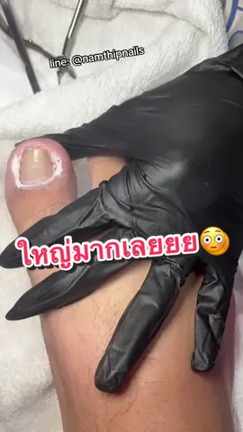 💓 #namthipnails #ตัดเล็บขบ #ตัดหนัง #ทำเล็บ #ร้านตัดเล็บขบ      Fb : namthipnails  Line : @namthipnails  นัมเบอร์วัน8 ตลาดม.ราม2  กทม  Map: namthipnails  https://goo.gl/maps/JmwpCKLfKwmhKGK96  ร้านเปิดทุกวัน เวลา12.00น-22.00น.