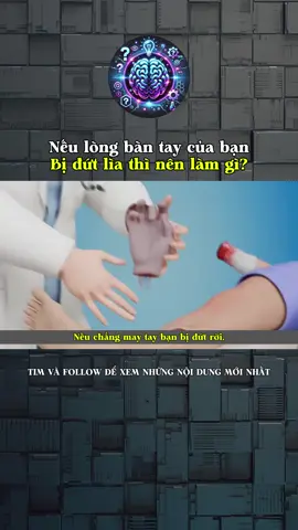 Nếu lòng bàn tay của bạn bị đứt lìa thì nên làm gì?#LearnOnTikTok #kienthuc #khoahoc #kienthucthuvi #khampha #doisong #vohankienthuc #xh