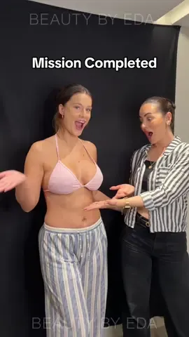 Part 2 is live 🌸 Breast Lift with 280cc implants — beautifully loaded 👯‍♀️ @beautyby.eda . 💬WA - link in bio!  🤍The best solution 🩺 The best doctor 📍 On your desired plastic surgery journey in Istanbul .  #transformation #plasticsurgery #beforeafter #estetik #plasticsurgeryistanbul 