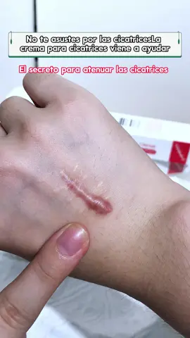 Help! This scar removal cream made my legs smoother than eggs!#scar #scarcream #beauty 