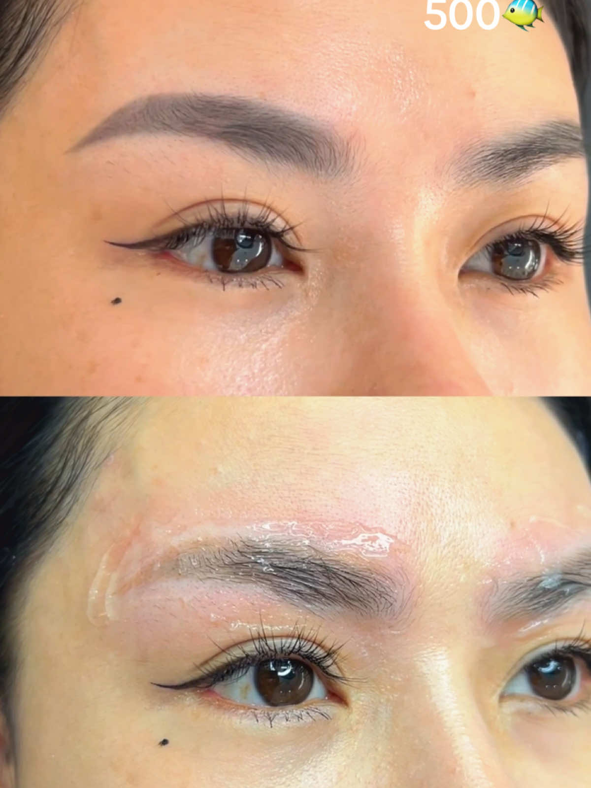 Laser bên em hiệu quả lắm khách ơi #shinebeauty #phunxamgovap #xoalaser #xoá_xăm #xoá_sửa_chân_mày 