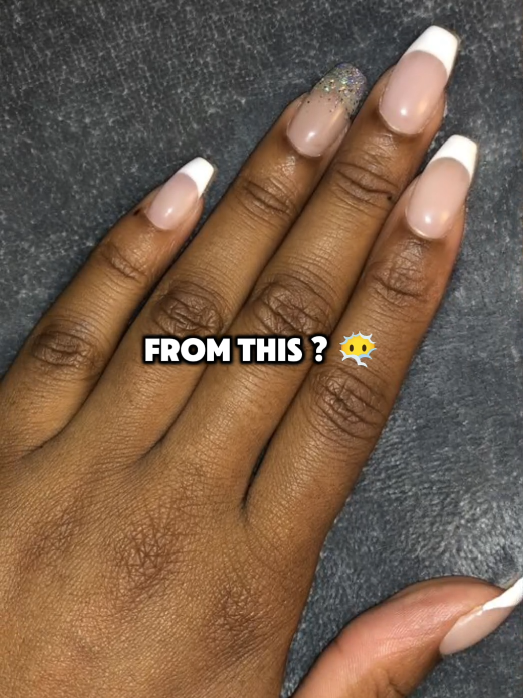 hands care tips 🎀 how to get bright skin #GlowUp #koreanskincare #beautytips #shorts #fypageシ 