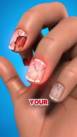 five signs in your fingernails that could be warning you about hidden health problems #nail #fingernails #pain #usa_tiktok 