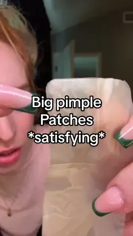 Litbear patches have been mind blowing lately… This is so satisfying to get out of your skin whether it’s a little bit or a lot #pimplepatches #pimple #acne #potestrip #satisfying 